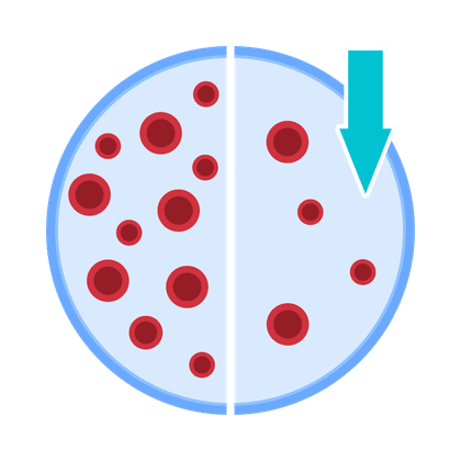 Anemia (iron deficiency)